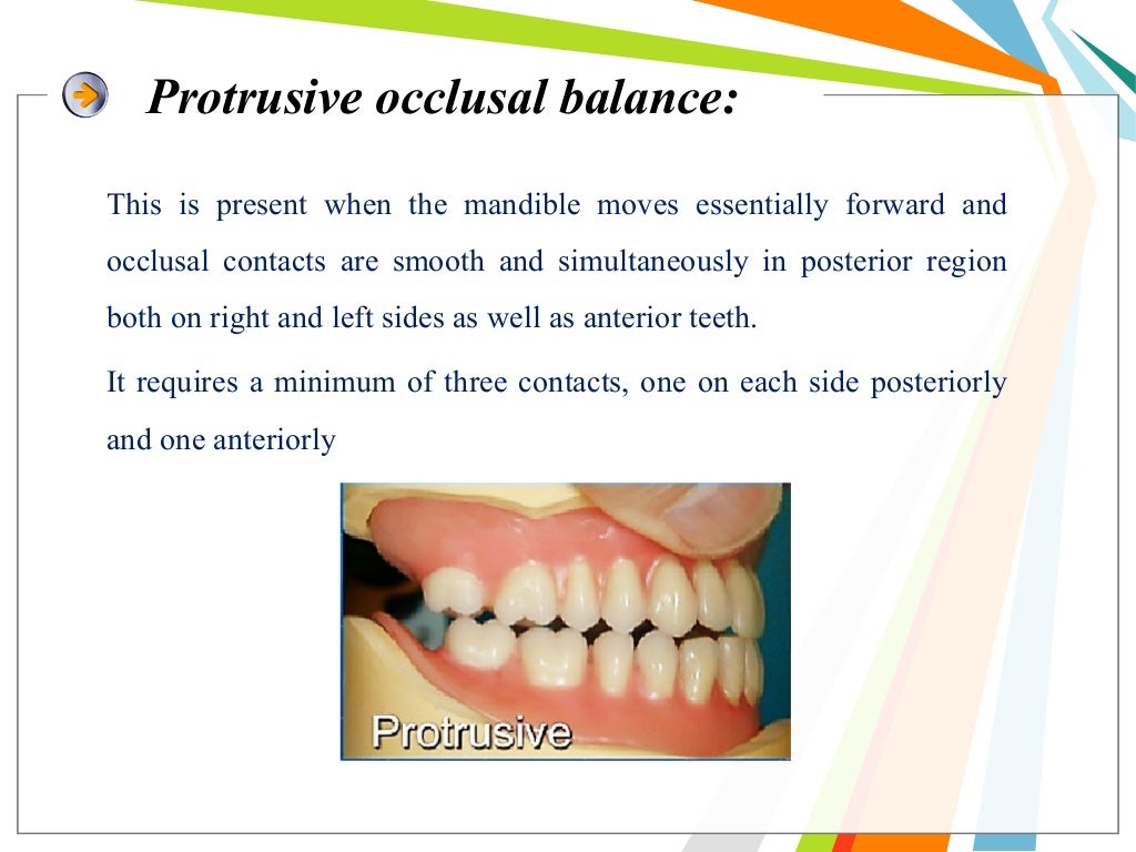 Balanced occlusion and its importance