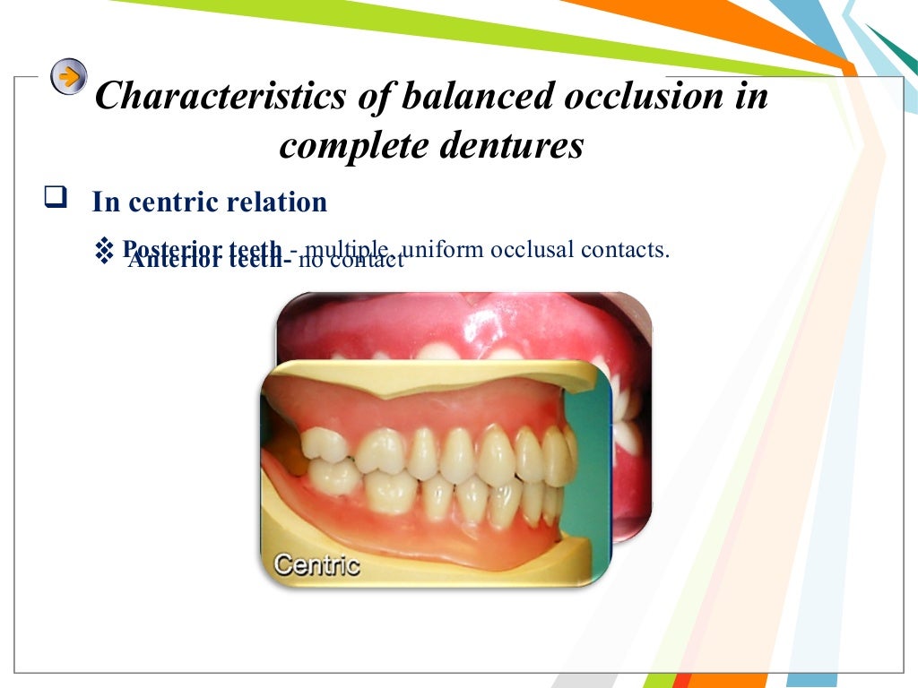 Balanced occlusion and its importance