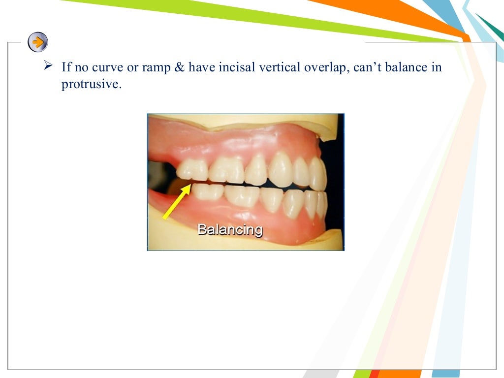 Balanced occlusion and its importance