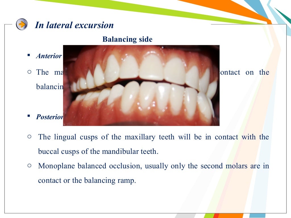 Balanced occlusion and its importance