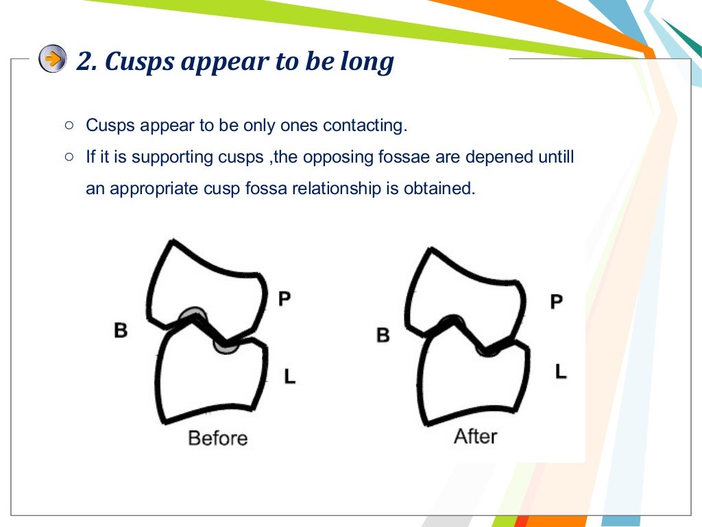Balanced occlusion and its importance
