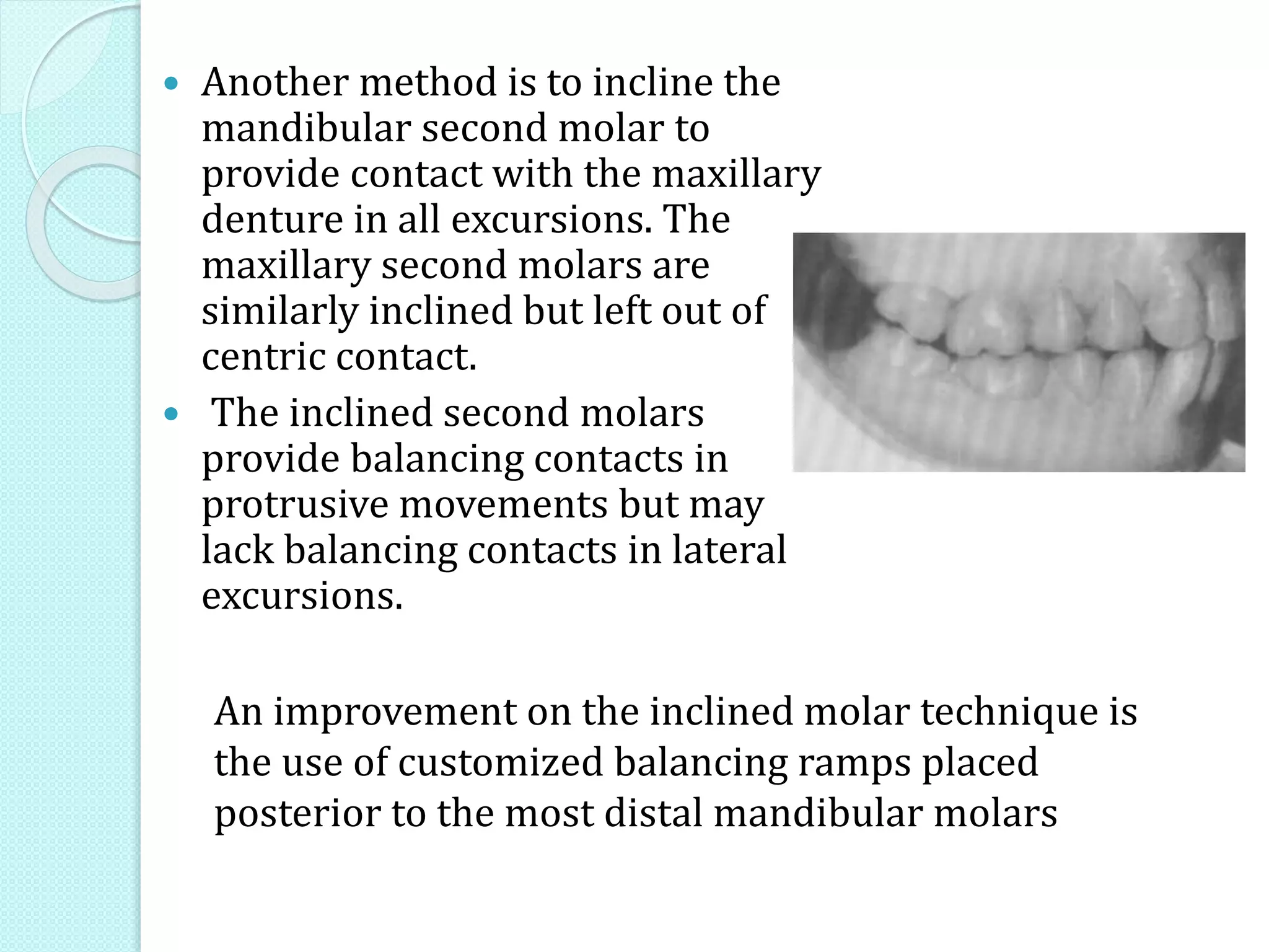 Balanced occlusion-different concepts | PPTX