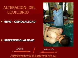 HIPO - OSMOLALIDAD HIPEROSMOLALIDAD CONCENTRACIÓN PLASMATICA DEL Na APORTE EXCRECIÓN ALTERACION  DEL  EQUILIBRIO / 