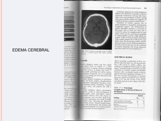 EDEMA CEREBRAL 