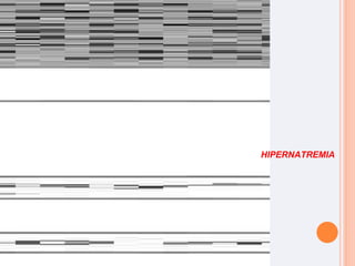 HIPERNATREMIA 