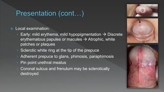 Mild Balanitis Xerotica Obliterans