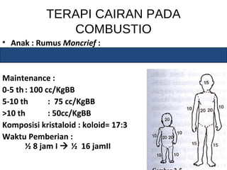 TERAPI CAIRAN PADA 
COMBUSTIO 
• Anak : Rumus Moncrief : 
(2xBBxluas combustio)+kebut faali maintenance 
Maintenance : 
0-5 th : 100 cc/KgBB 
5-10 th : 75 cc/KgBB 
>10 th : 50cc/KgBB 
Komposisi kristaloid : koloid= 17:3 
Waktu Pemberian : 
½ 8 jam I  ½ 16 jamII 
16 
 