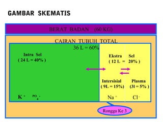 GAMBAR SKEMATIS 
BERAT BADAN (60 KG) 
CAIRAN TUBUH TOTAL 
Ekstra Sel 
( 12 L = 20% ) 
36 L = 60% 
Intersisial Plasma 
( 9L = 15%) (3l = 5% ) 
Na + Cl - 
Intra Sel 
( 24 L = 40% ) 
K + PO 
4 
- 
Rongga Ke 3 
 