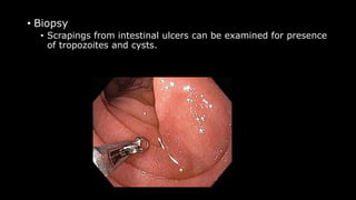 • Biopsy
• Scrapings from intestinal ulcers can be examined for presence
of tropozoites and cysts.
 