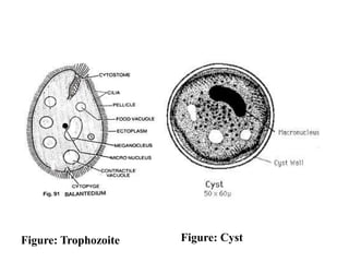 Figure: Trophozoite Figure: Cyst
 