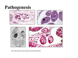 Pathogenesis
 