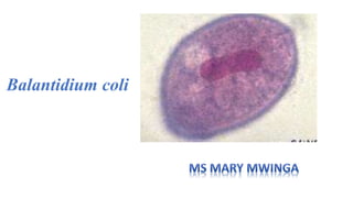Balantidium coli
 