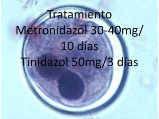 Tratamiento 
Metronidazol 30-40mg/ 
10 días 
Tinidazol 50mg/3 días 
 