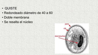 • QUISTE
• Redondeado diámetro de 40 a 60
• Doble membrana
• Se resalta el núcleo
 