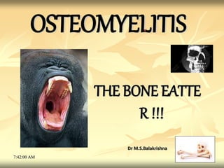 OSTEOMYELITIS
THE BONE EATTE
R !!!
Dr M.S.Balakrishna
7:42:00 AM 1
 