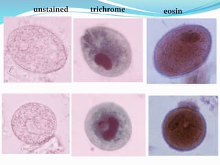 unstained trichrome eosin
 