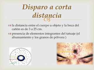 
 la distancia entre el cuerpo u objeto y la boca del
cañón es de 3 a 25 cm.
 presencia de elementos integrantes del tatuaje (el
ahumamiento y los granos de pólvora )
Disparo a corta
distancia
 