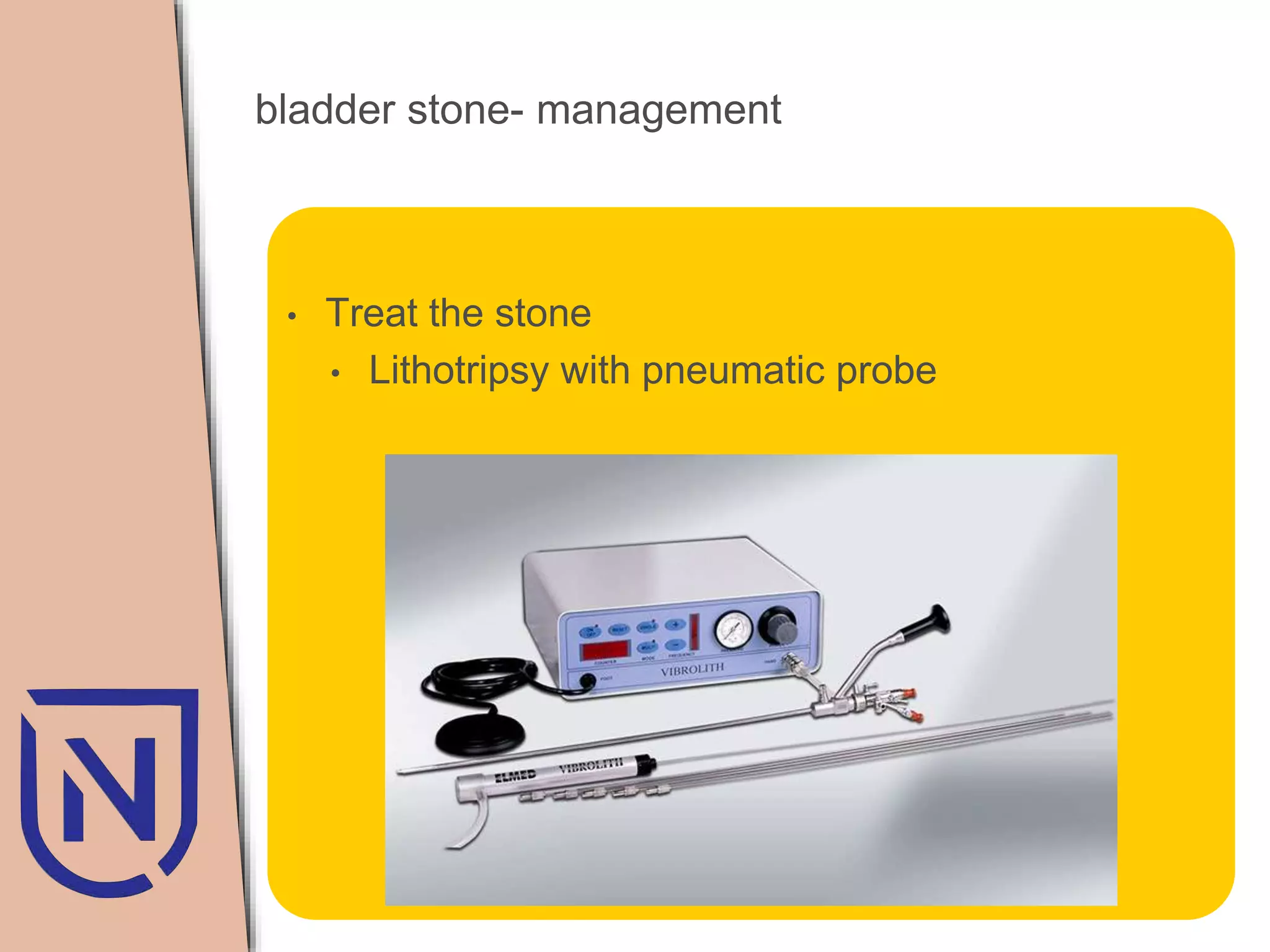Baldder calculi neo | PPTX