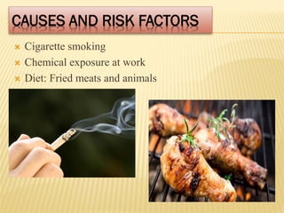 CAUSES AND RISK FACTORS
 Cigarette smoking
 Chemical exposure at work
 Diet: Fried meats and animals
 