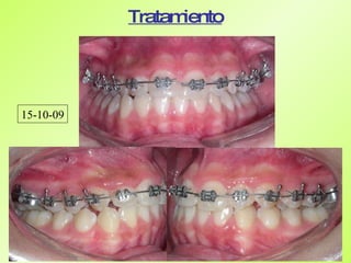 Caso de ortodoncia