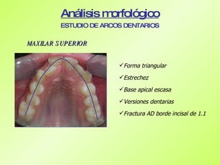 Caso de ortodoncia