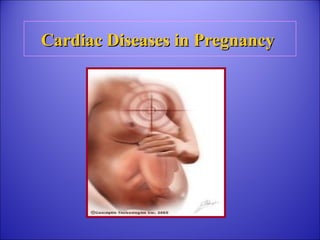 Cardiac Diseases in PregnancyCardiac Diseases in Pregnancy
 