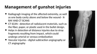 Comprehensive Overview of Ballistic Injuries: Types, Effects, and ...