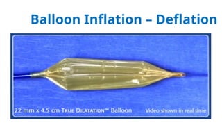 Balloon Angioplasty Basics (Ahmed AlRefaiy). | PPTX