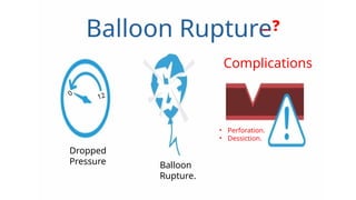 Balloon Angioplasty Basics (Ahmed AlRefaiy). | PPTX