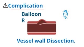 Balloon Angioplasty Basics (Ahmed AlRefaiy). | PPTX