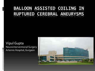 BALLOON ASSISTED COILING IN
RUPTURED CEREBRAL ANEURYSMS
Vipul Gupta
Neurointerventional Surgery
Artemis Hospital, Gurgaon
 