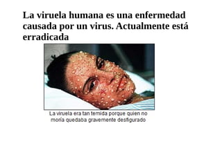 La viruela humana es una enfermedad
causada por un virus. Actualmente está
erradicada
 
