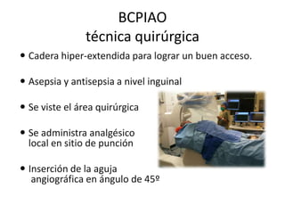 BCPIAO
técnica quirúrgica
 Cadera hiper-extendida para lograr un buen acceso.
 Asepsia y antisepsia a nivel inguinal
 Se viste el área quirúrgica
 Se administra analgésico
local en sitio de punción

 Inserción de la aguja
angiográfica en ángulo de 45º

 