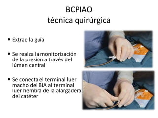 BCPIAO
técnica quirúrgica
 Extrae la guía
 Se realza la monitorización
de la presión a través del
lúmen central
 Se conecta el terminal luer
macho del BIA al terminal
luer hembra de la alargadera
del catéter

 