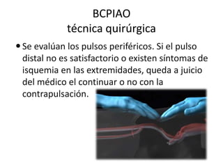 BCPIAO
técnica quirúrgica
 Se evalúan los pulsos periféricos. Si el pulso
distal no es satisfactorio o existen síntomas de
isquemia en las extremidades, queda a juicio
del médico el continuar o no con la
contrapulsación.

 