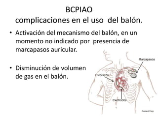 BCPIAO
complicaciones en el uso del balón.
• Activación del mecanismo del balón, en un
momento no indicado por presencia de
marcapasos auricular.

• Disminución de volumen
de gas en el balón.

 