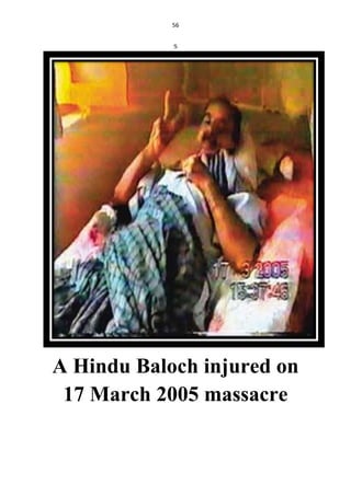 56
S
A Hindu Baloch injured on
17 March 2005 massacre
 