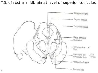 T.S. of rostral midbrain at level of superior colliculus.
 