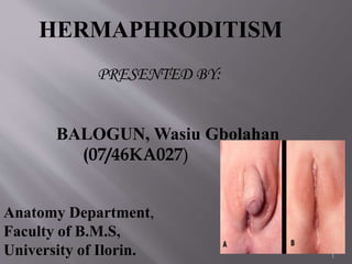 HERMAPHRODITISM
PRESENTED BY:
BALOGUN, Wasiu Gbolahan
(07/46KA027)
Anatomy Department,
Faculty of B.M.S,
University of Ilorin. 1
 