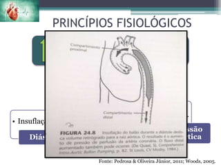 PRINCÍPIOS FISIOLÓGICOS
• Insuflação
Diástole
• + 40mL na Aorta
• Pressão aórtica
Deslocamento
de volume • Perf.
Art. Cor.
Pressão
Aórtica
Perfusão das A. coronárias;
Diminuir a carga de trabalho de VE;
Fonte: Pedrosa & Oliveira Júnior, 2011; Woods, 2005.
 