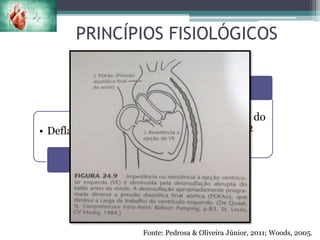 PRINCÍPIOS FISIOLÓGICOS
• Deflação
Sístole
• Carga de trabalho do
VE e demanda de O2
Pós-carga
Fonte: Pedrosa & Oliveira Júnior, 2011; Woods, 2005.
 