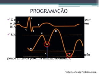 PROGRAMAÇÃO
 O momento de insuflação e deflação deve coincidir com
o ciclo cardíaco para garantir a eficácia da terapia com
BIA;
 Sincronismo Convencional:
- Insuflação ocorre na incisura dicrótica, e deflação
pouco antes da próxima inflexão acentuada;
Fonte: Morton & Fontaine, 2014 .
Mecanismo de gatilho: curva da pressão
arterial
 