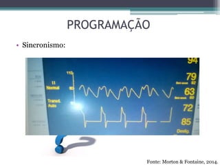 PROGRAMAÇÃO
• Sincronismo:
Fonte: Morton & Fontaine, 2014.
1:1 1:2 1:3
 
