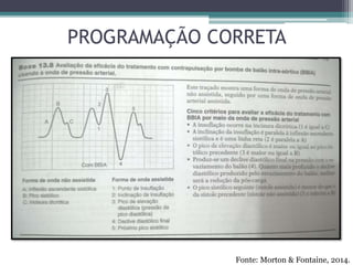 PROGRAMAÇÃO CORRETA
Fonte: Morton & Fontaine, 2014.
 