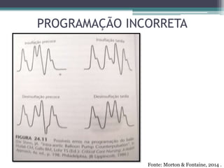 PROGRAMAÇÃO INCORRETA
Fonte: Morton & Fontaine, 2014 .
 