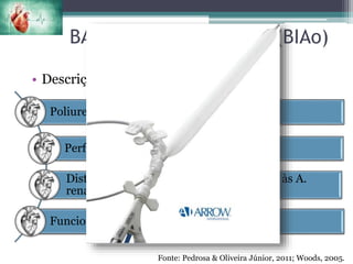 BALÃO INTRA-AÓRTICO (BIAo)
Fonte: Pedrosa & Oliveira Júnior, 2011; Woods, 2005.
• Descrição:
Poliuretano biocompatível;
Perfuração na conexão cateter-balão;
Distal à A. subclávia esquerda e proximal às A.
renais;
Funciona através de contrapulsação;
 