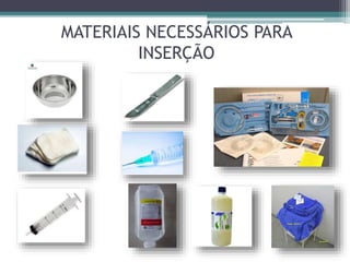 MATERIAIS NECESSÁRIOS PARA
INSERÇÃO
 