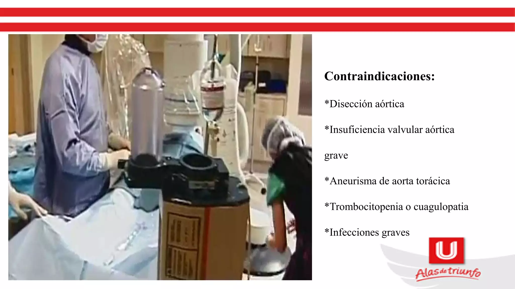 Contraindicaciones:
*Disección aórtica
*Insuficiencia valvular aórtica
grave
*Aneurisma de aorta torácica
*Trombocitopenia o cuagulopatia
*Infecciones graves
 