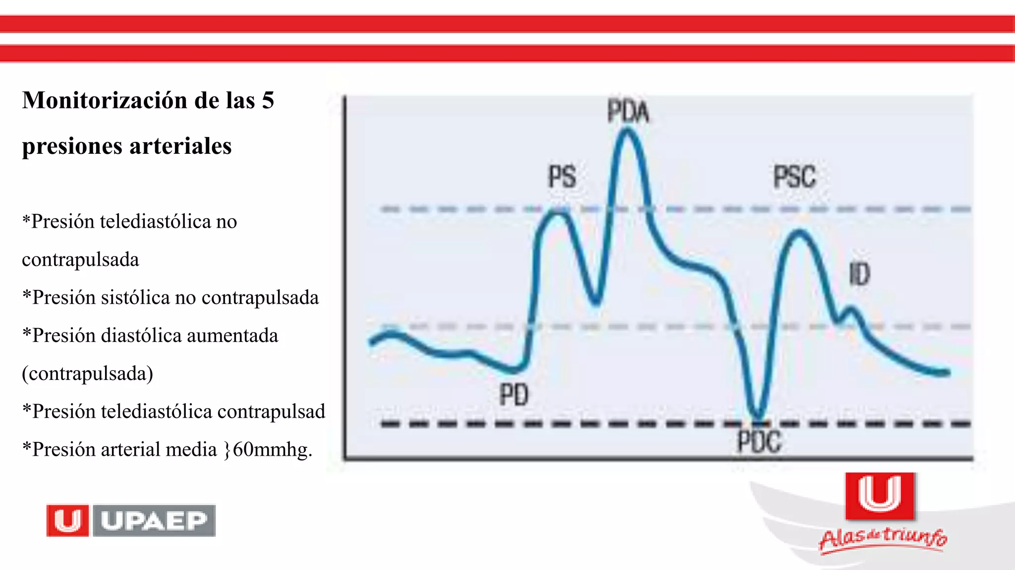 Monitorización de las 5
presiones arteriales
*Presión telediastólica no
contrapulsada
*Presión sistólica no contrapulsada
*Presión diastólica aumentada
(contrapulsada)
*Presión telediastólica contrapulsada
*Presión arterial media }60mmhg.
 