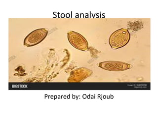 Stool analysis
Prepared by: Odai Rjoub
 